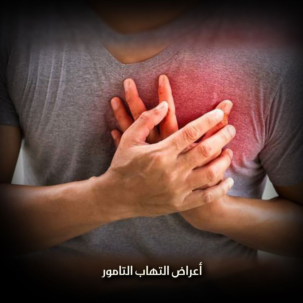 التهاب غشاء التامور