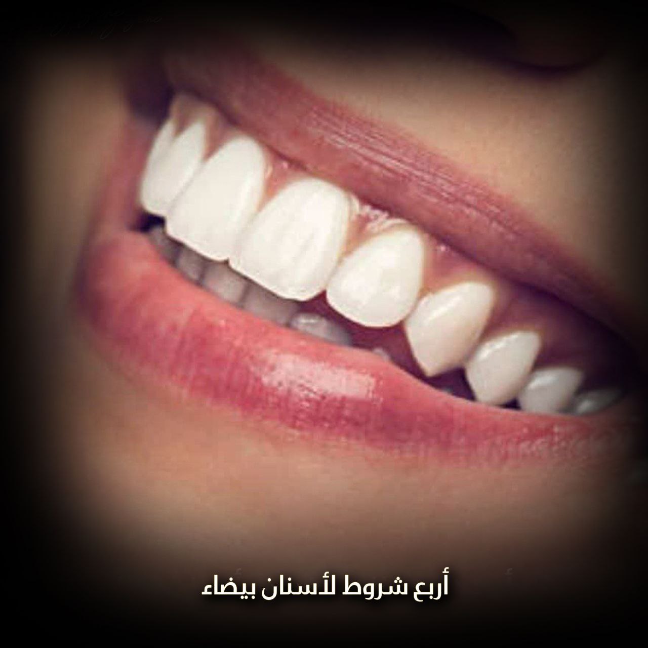أربع شروط لأسنان بيضاء