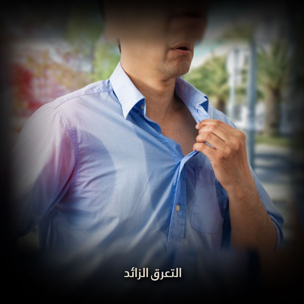 التعرق الزائد