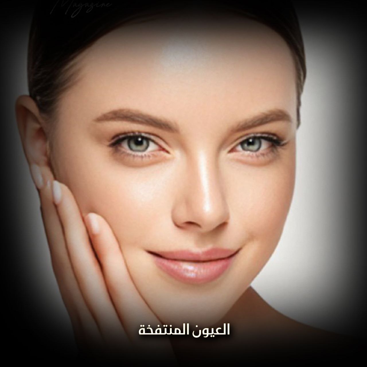 العيون المنتفخة