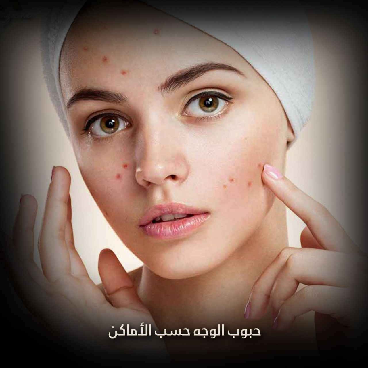 حبوب الوجه حسب الأماكن
