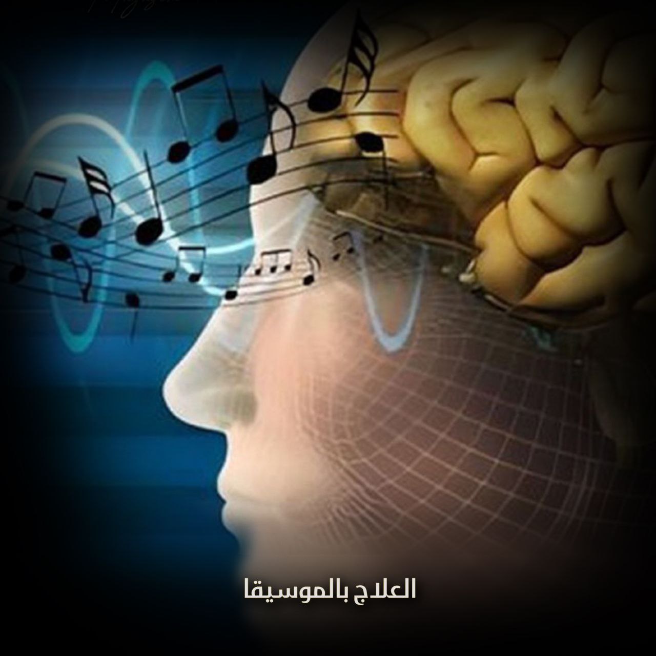 العلاج بالموسيقا