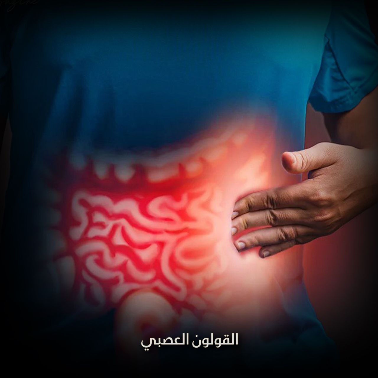 القولون العصبي