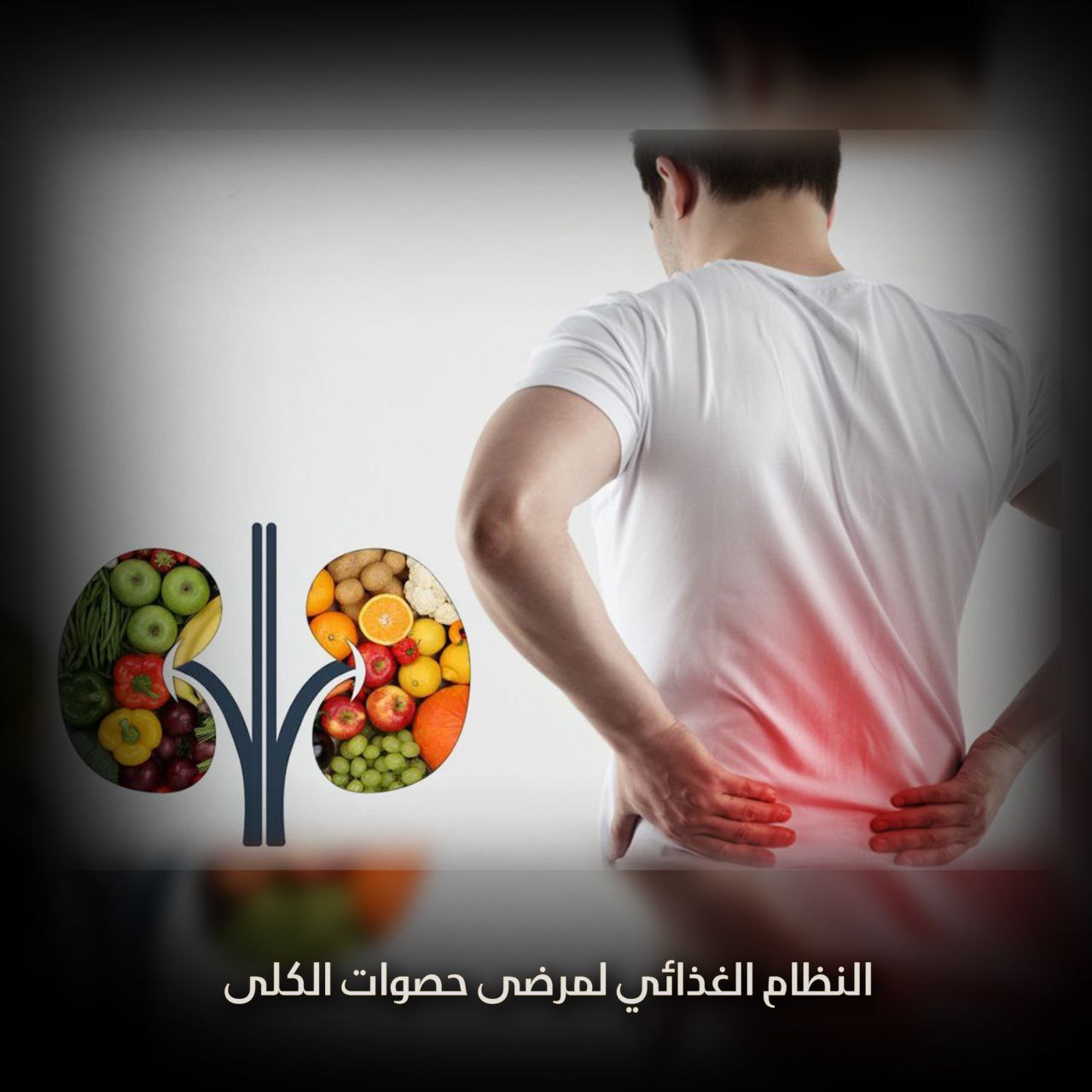 النظام الغذائي لمرضى حصوات الكلى