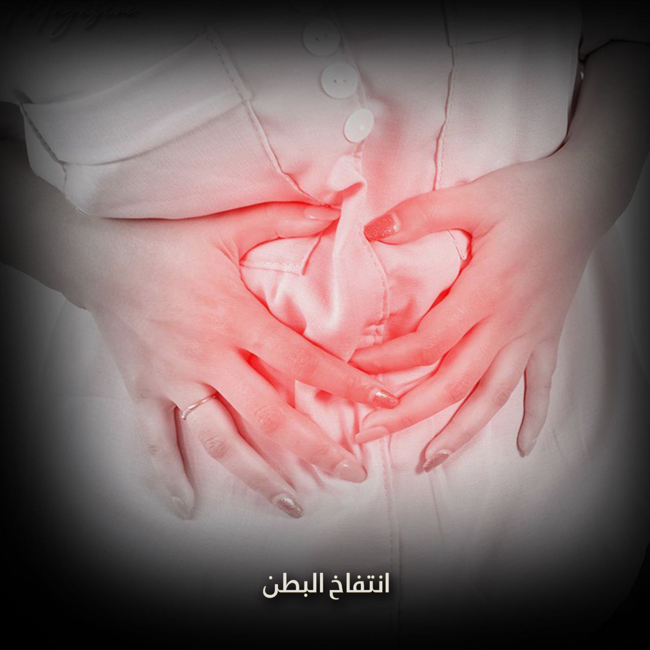 انتفاخ البطن