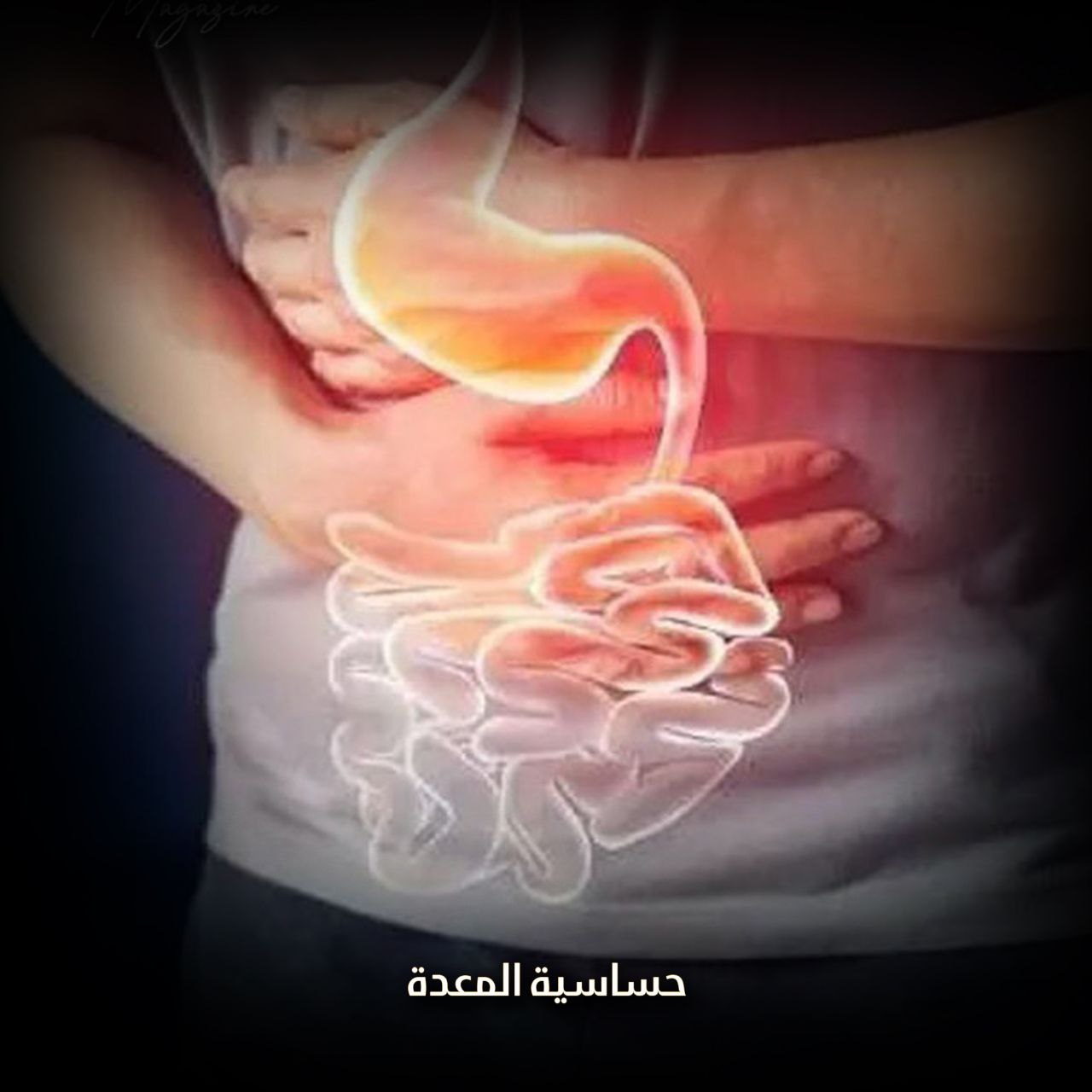 حساسية المعدة
