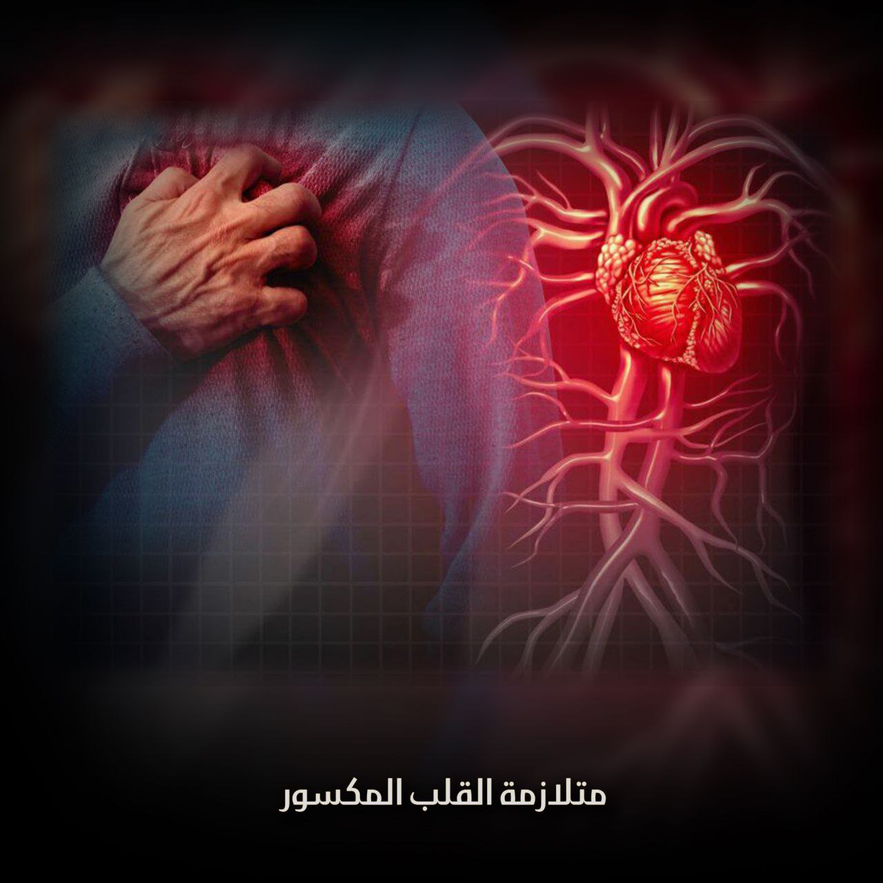 متلازمة القلب المحطم