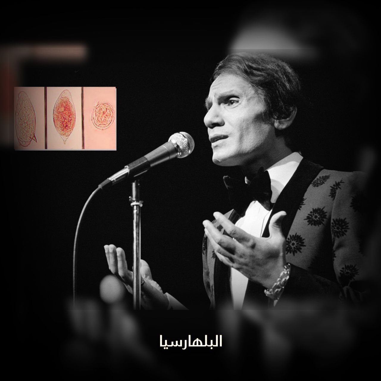 البلهارسيا