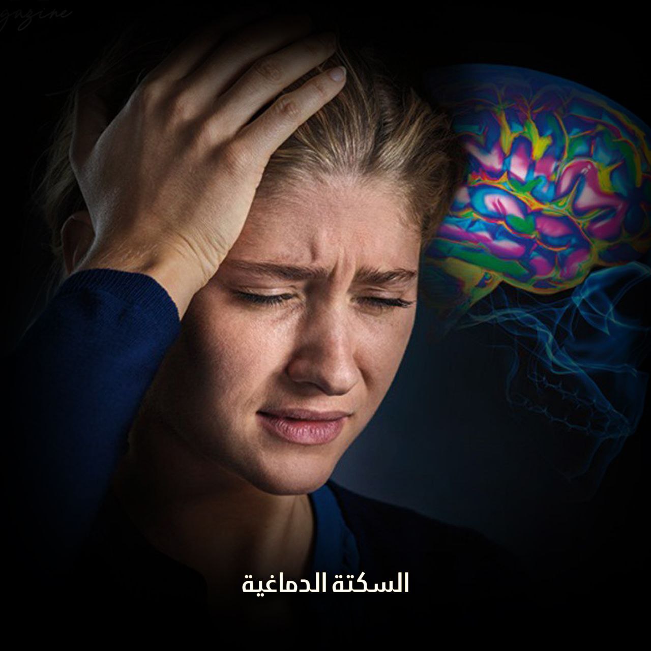 السكتة الدماغية