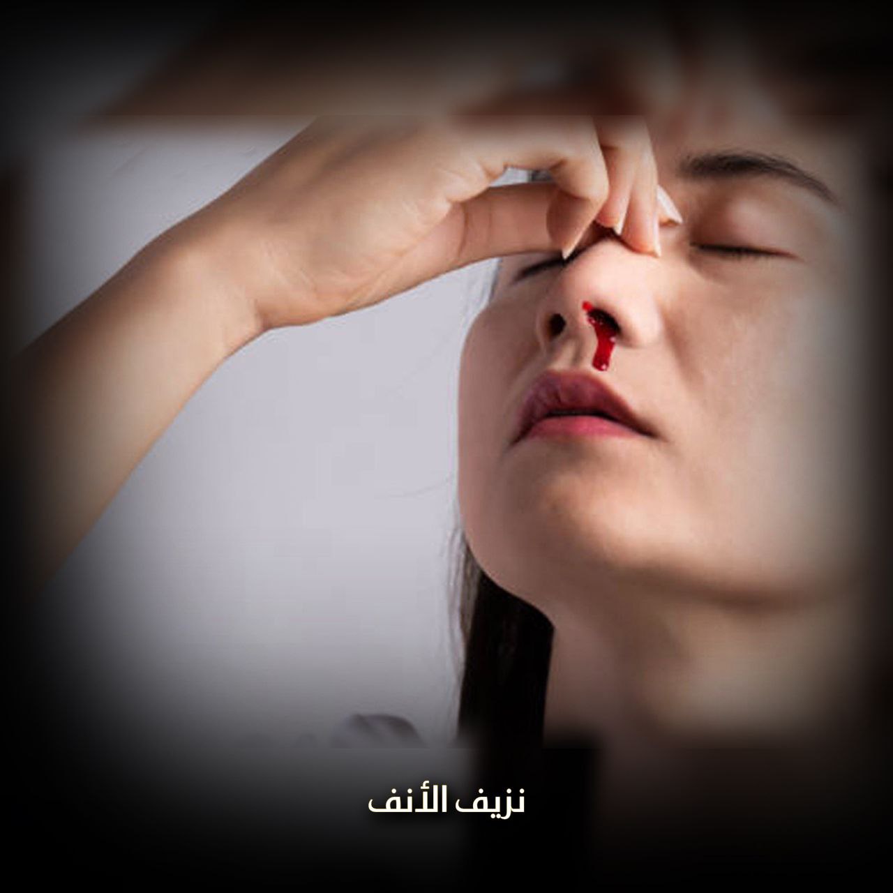 نزيف الأنف