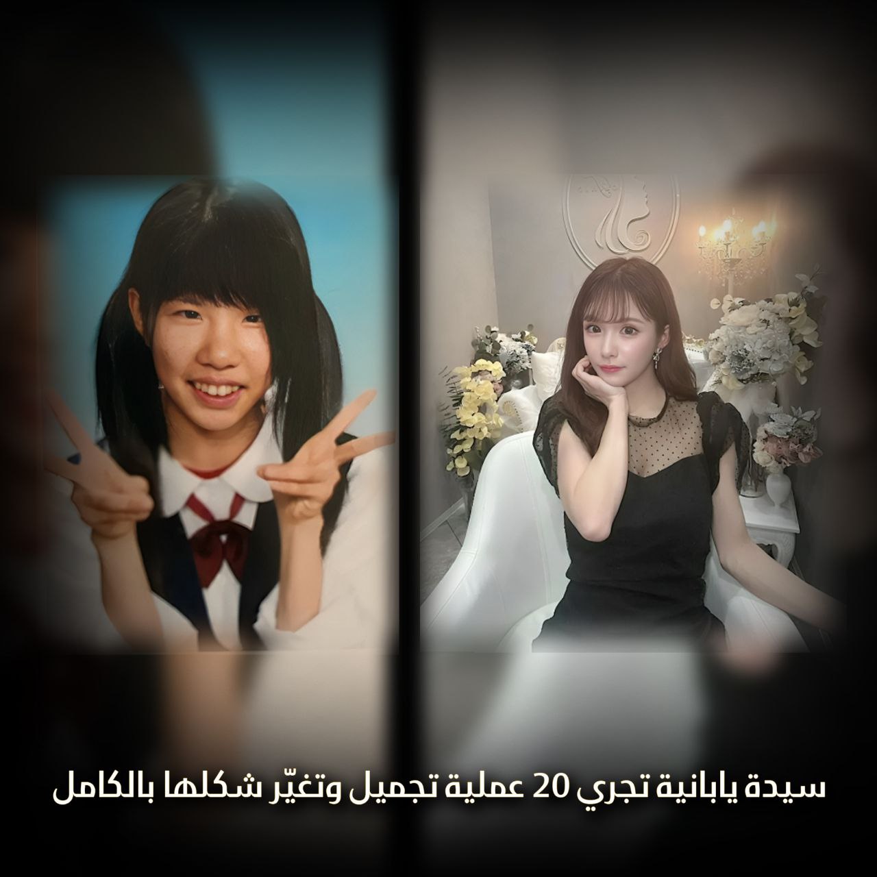 سيدة يابانية تجري 20 عملية تجميل وتغير شكلها بالكامل