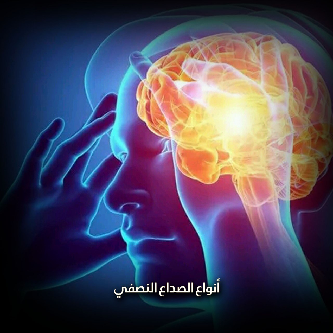 أنواع الصداع النصفي