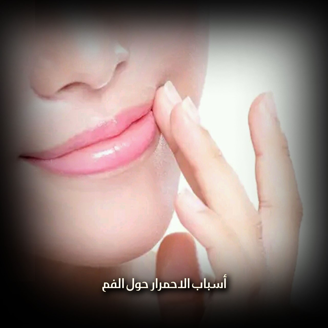 أسباب الاحمرار حول الفم