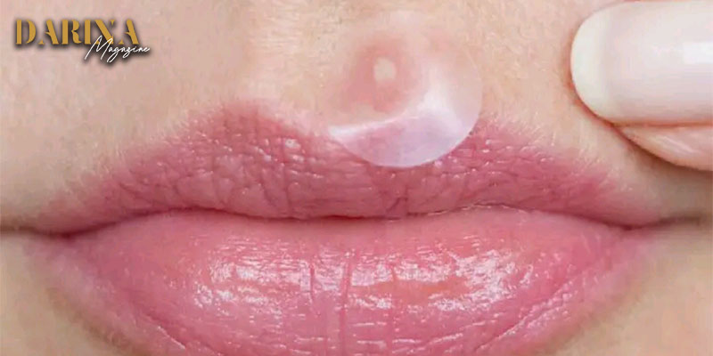 هل جربت يوماً لصاقات الحبوب؟