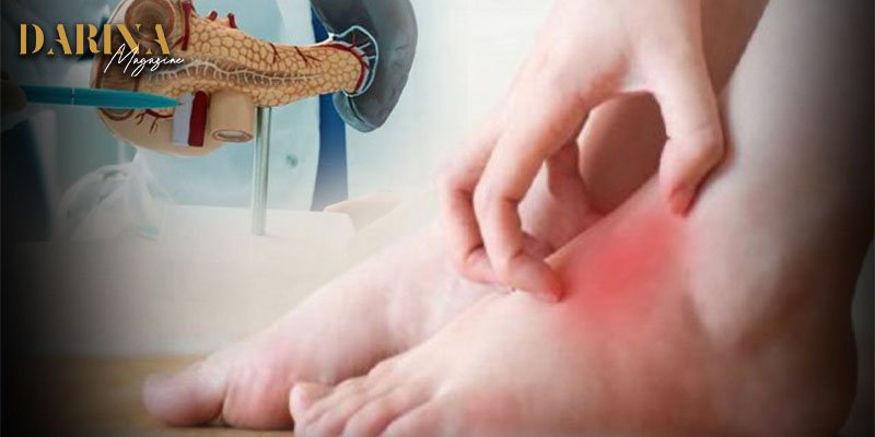 علامات تحذيرية في الساقين تشير إلى سرطان البنكرياس