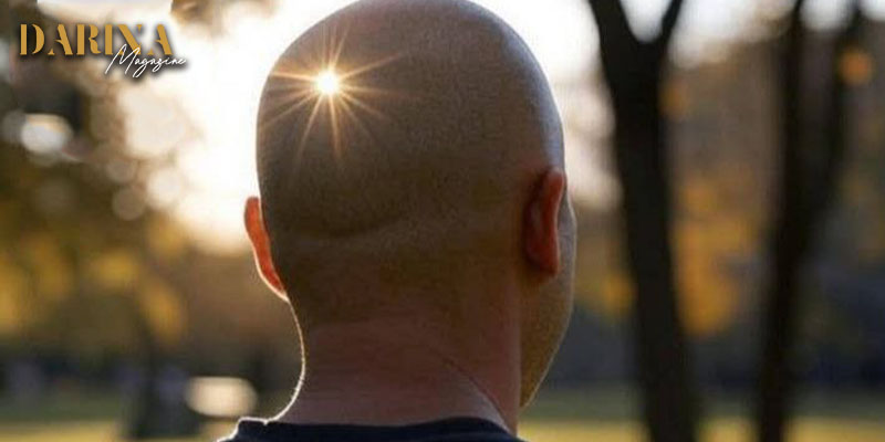 توليد الطاقة من صلعة الرجال من خلال أشعة الشمس