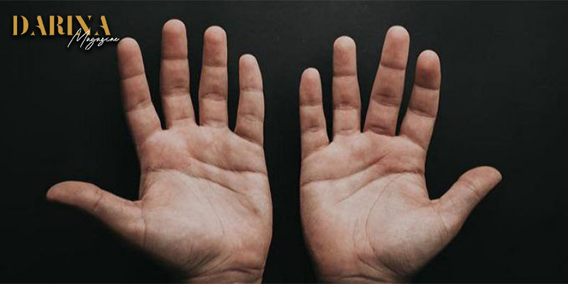 علامات الكبد الدهني تظهر على اليدين