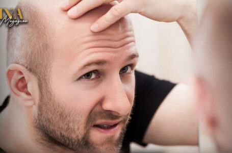 العالم على مشارف دواء سحري يعالج الصلع في 3 أسابيع