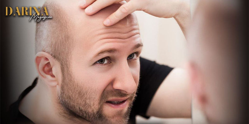 العالم على مشارف دواء سحري يعالج الصلع في 3 أسابيع