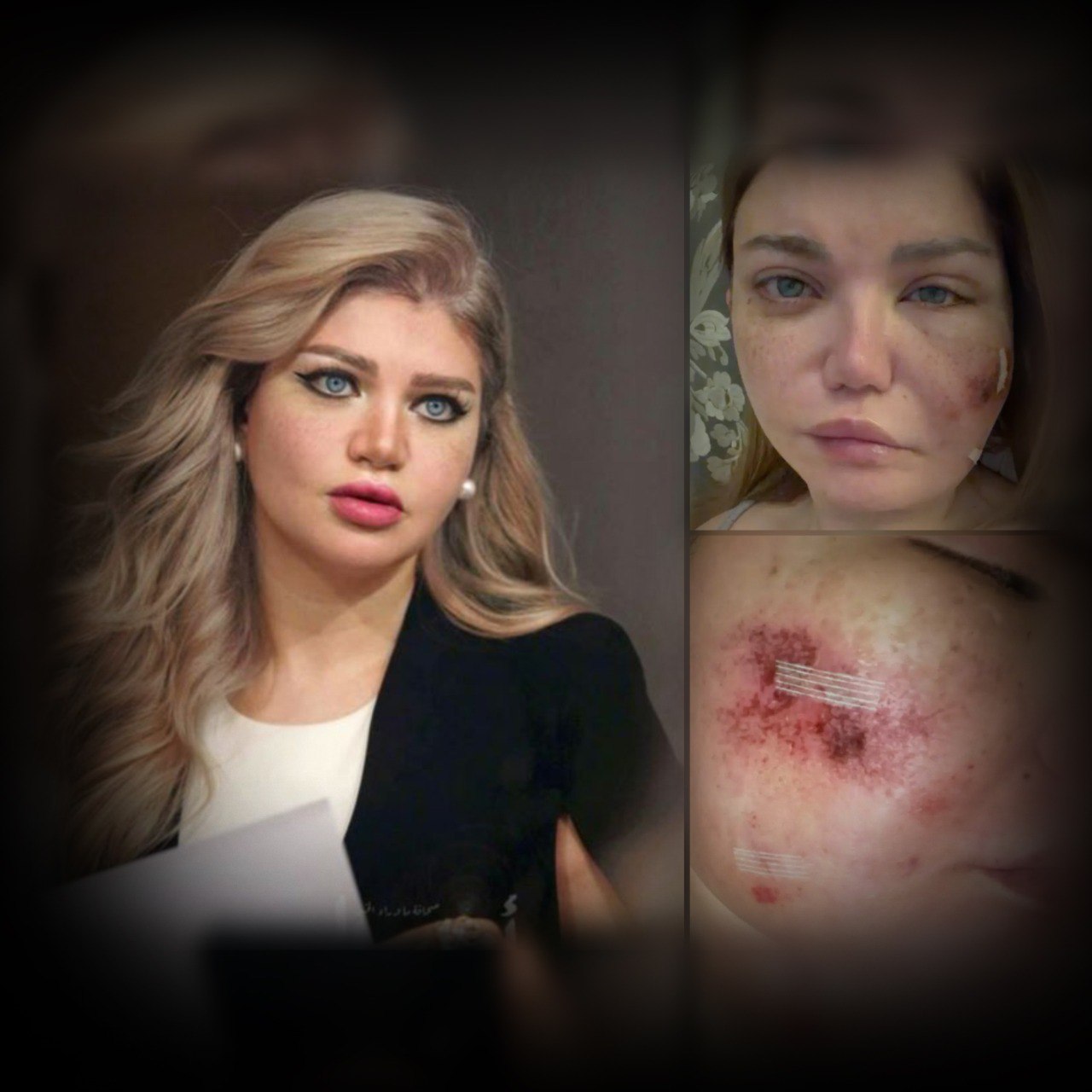 خضعت لجراحة دقيقة في الوجه.. الإعلامية “ياسمين الخطيب” تكشف أزمتها الصحية